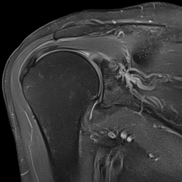 Sports Injuries