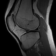 Knee